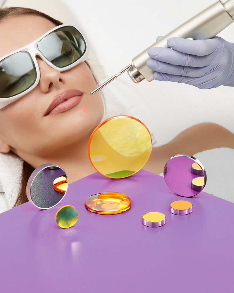 An assortment of Nd:YAG laser optics sit on top a purple table. A woman in the background wearing safety glasses is being treated by a medical laser.